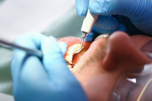 Best Emergency Denture Repair in Cattaraugus, NY